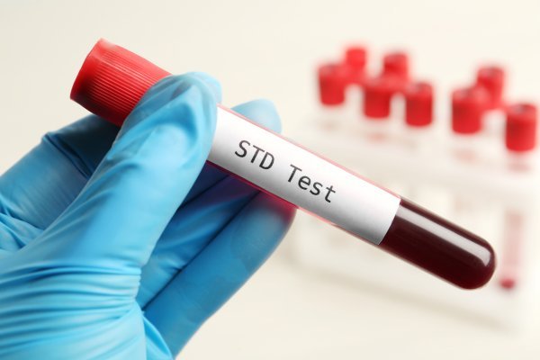 Common STD Test