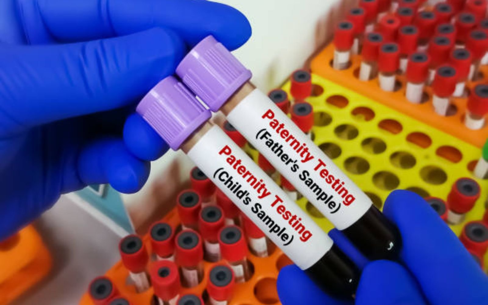 How Accurate Is a Paternity DNA Test? Everything You Need to Know in 2026
